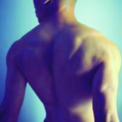 Reposição hormonal masculina